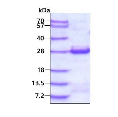 SDS-Page: Recombinant Human VBP1 His Protein [NBP2-22943] - 3ug by SDS-PAGE under reducing condition and visualized by coomassie blue stain.